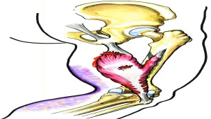 Anatomiske tegning av en hamstringsstrekk